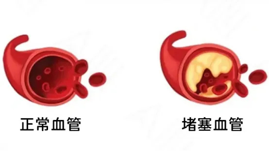 640_wx_fmt=png&from=appmsg&tp=webp&wxfrom=5&wx_lazy=1 (4)