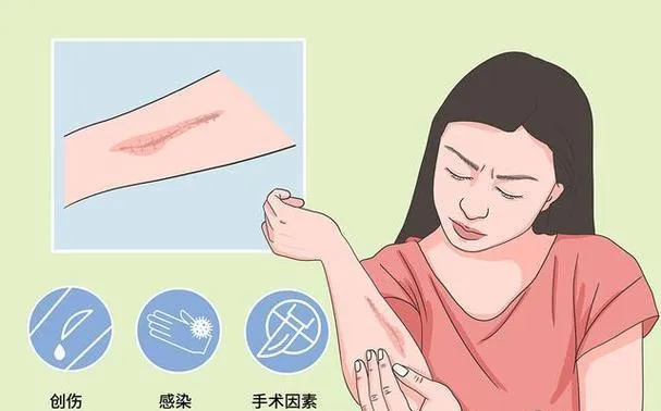 640_wx_fmt=png&from=appmsg&tp=webp&wxfrom=5&wx_lazy=1 (10)