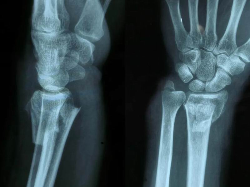 640_wx_fmt=png&from=appmsg&tp=webp&wxfrom=5&wx_lazy=1 (12)