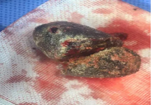 640_wx_fmt=png&from=appmsg&tp=webp&wxfrom=5&wx_lazy=1 (9)